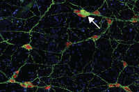 Columbia scientists have found that neurons in the gastrointestinal tract of mice are damaged by an autoimmune reaction to a protein associated with Parkinsons disease. (The arrow in this image points to a neuron). Their study is adding to evidence that t